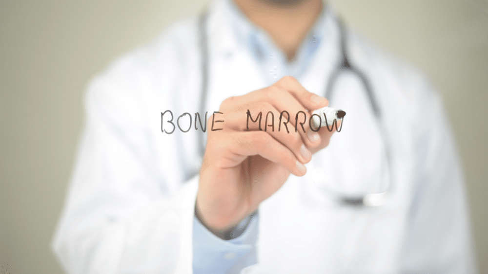 What Are Some Side Effects of Bone Marrow Transplants?
